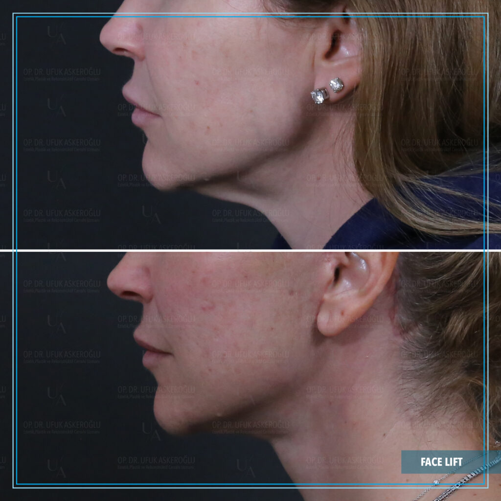 Best Facial Plastic Surgeon Best Facial Plastic Surgeon