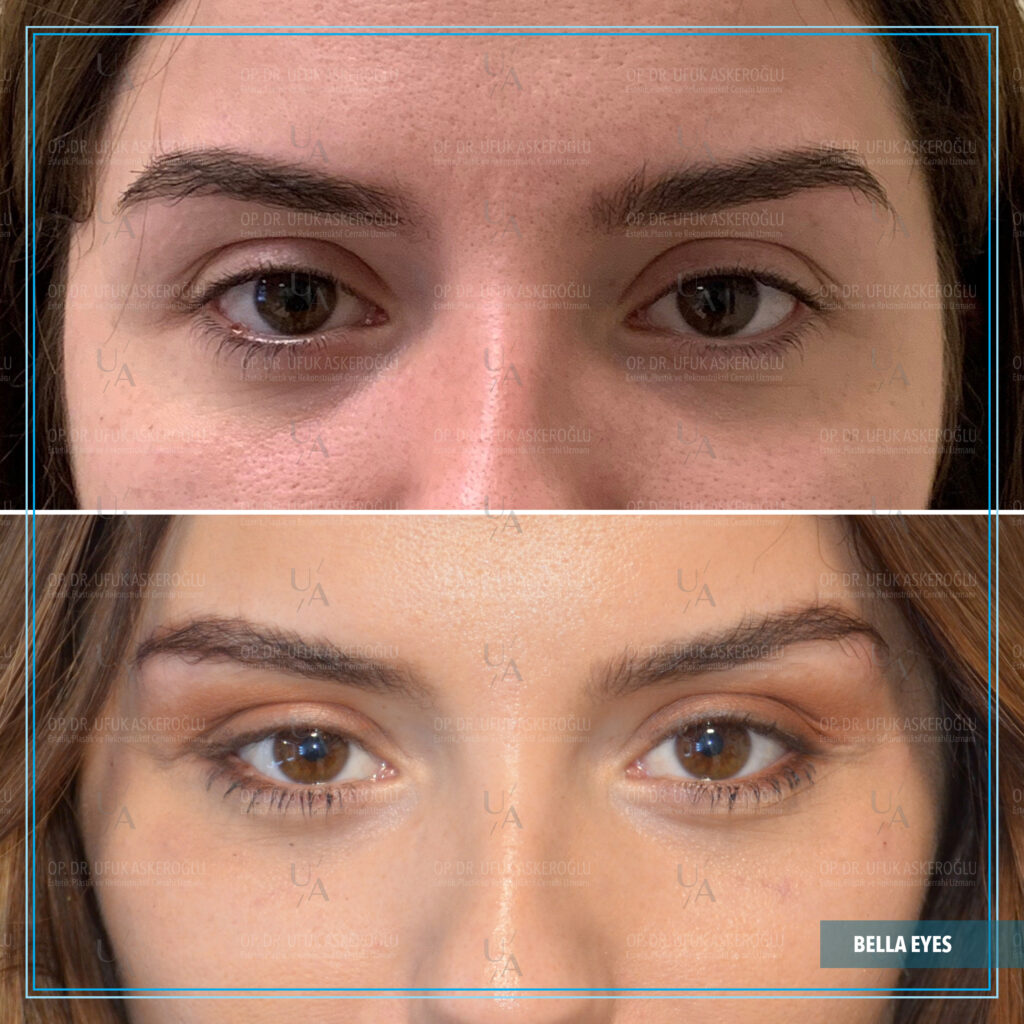 Best Facial Plastic Surgeon Best Facial Plastic Surgeon
