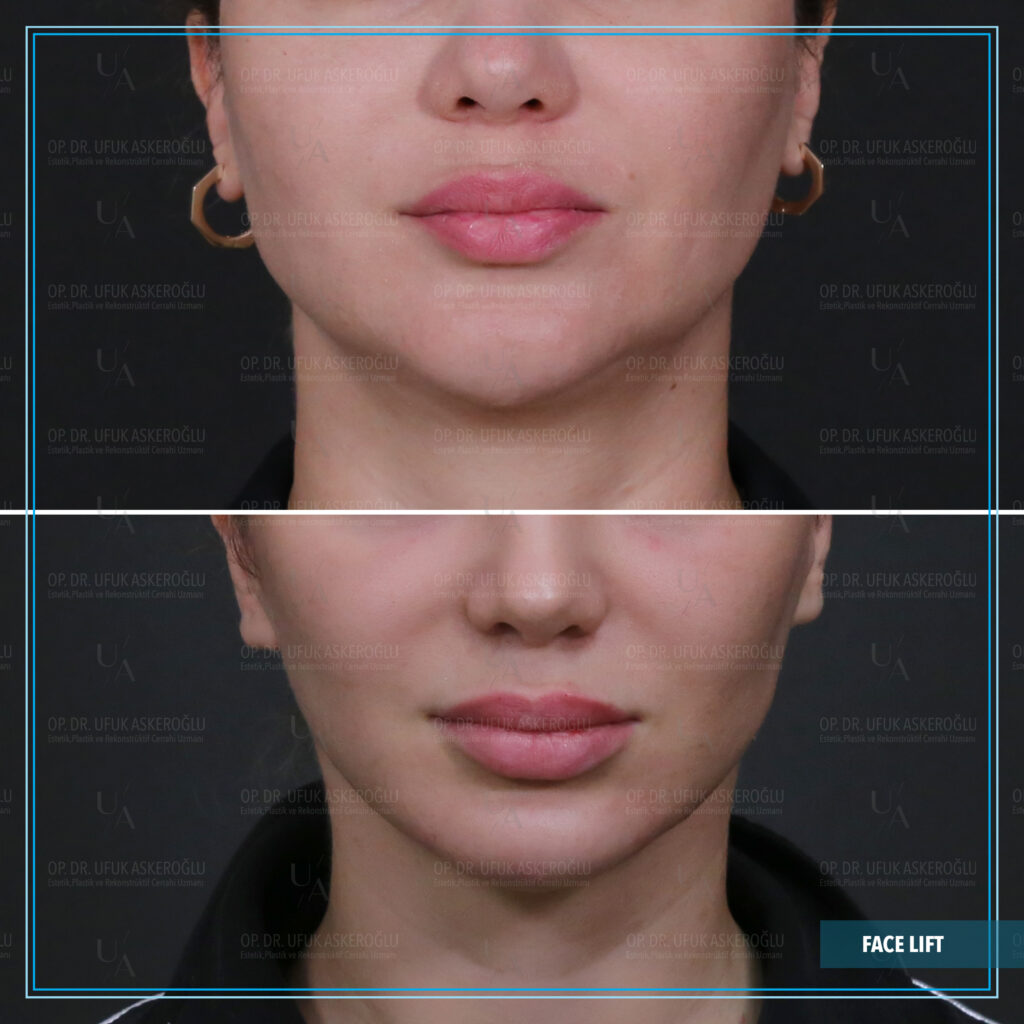 Best Facial Plastic Surgeon Best Facial Plastic Surgeon