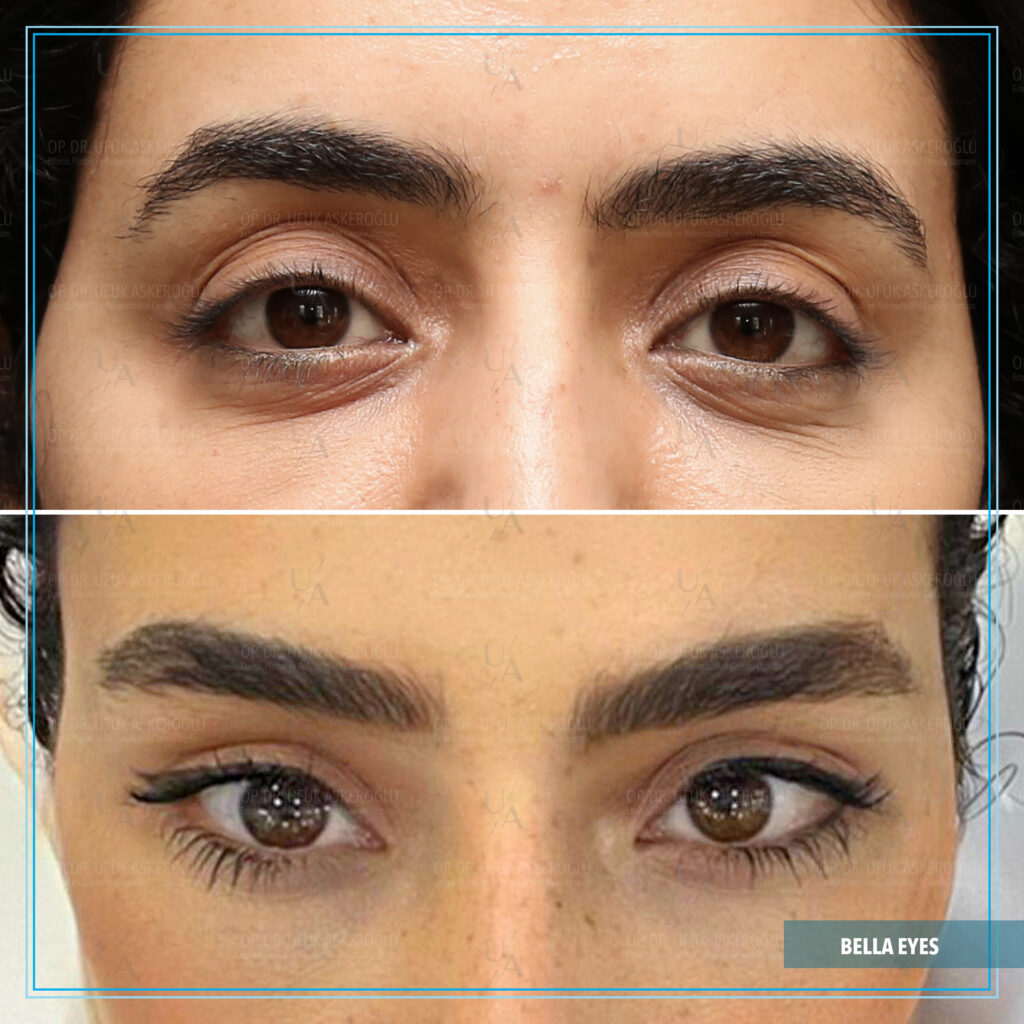 Best Facial Plastic Surgeon Best Facial Plastic Surgeon