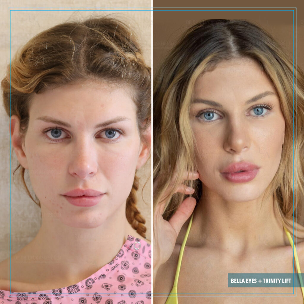 Best Facial Plastic Surgeon Best Facial Plastic Surgeon