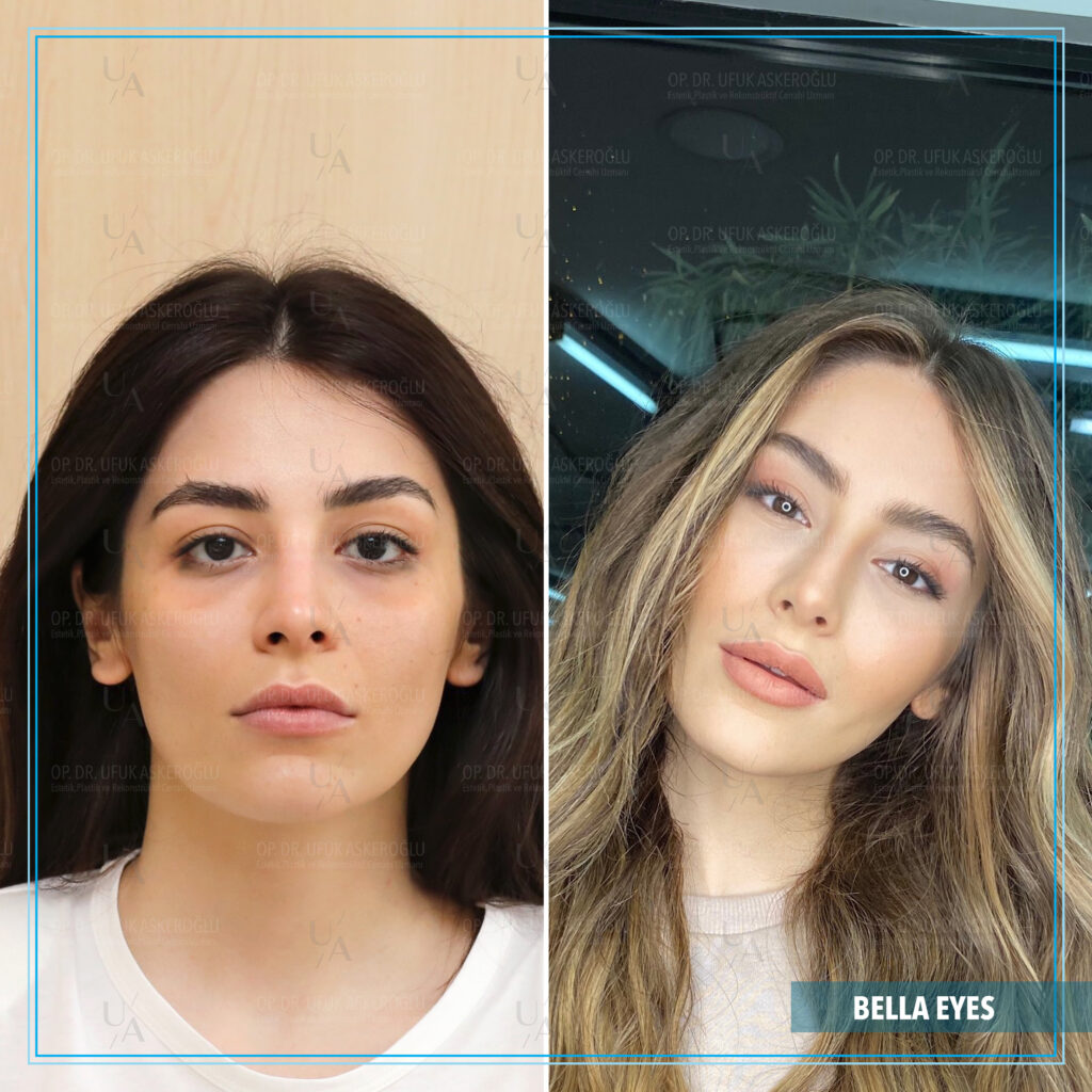 Best Facial Plastic Surgeon