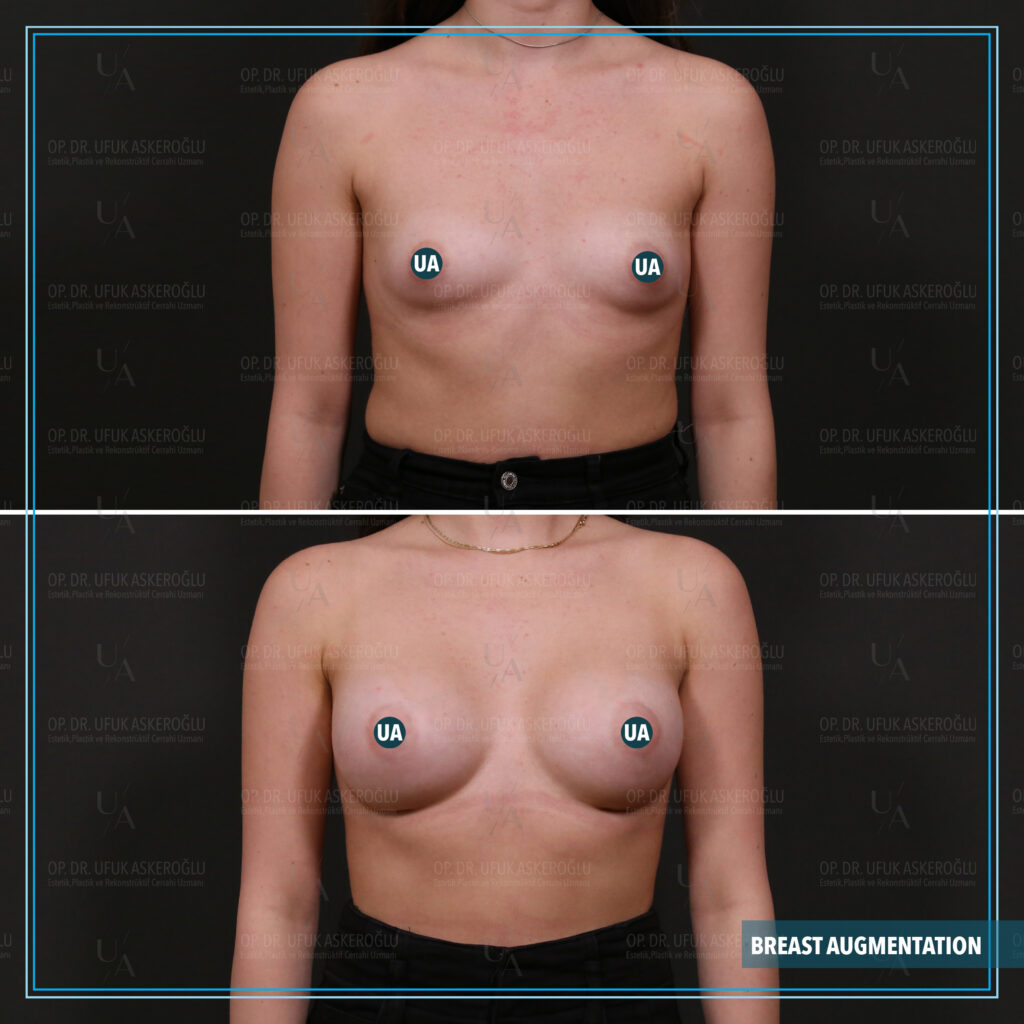 Best Facial Plastic Surgeon