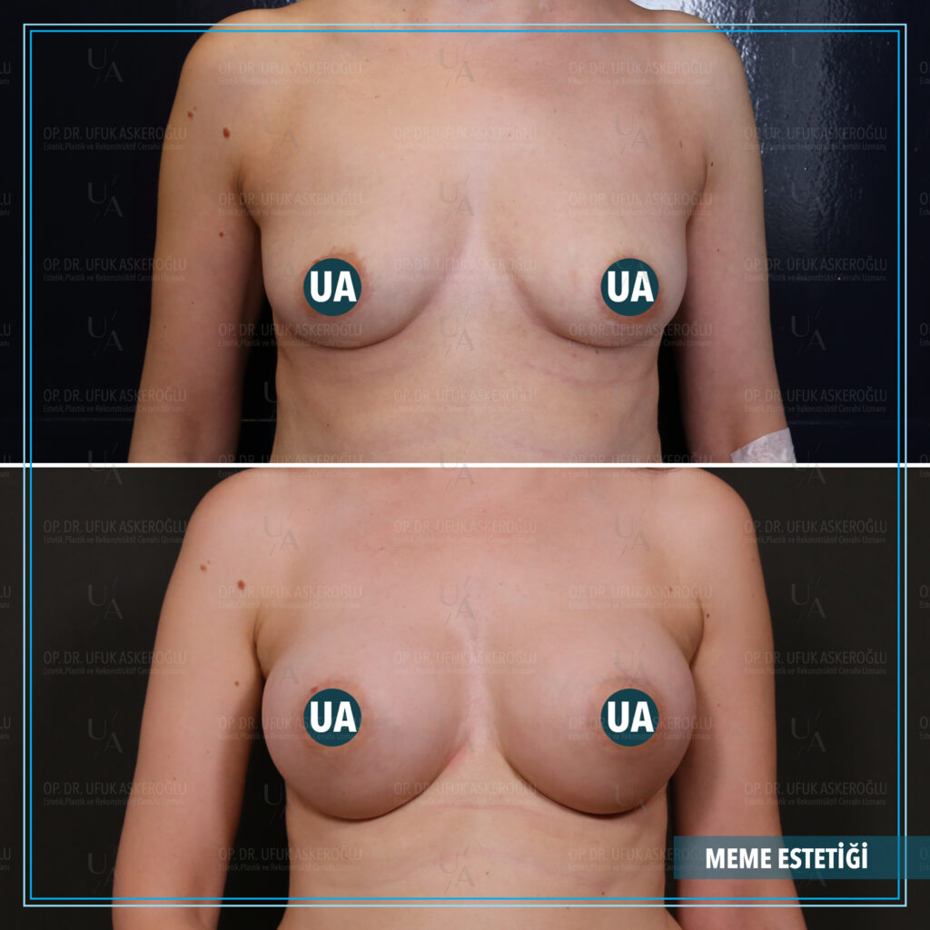 Best Facial Plastic Surgeon Best Facial Plastic Surgeon