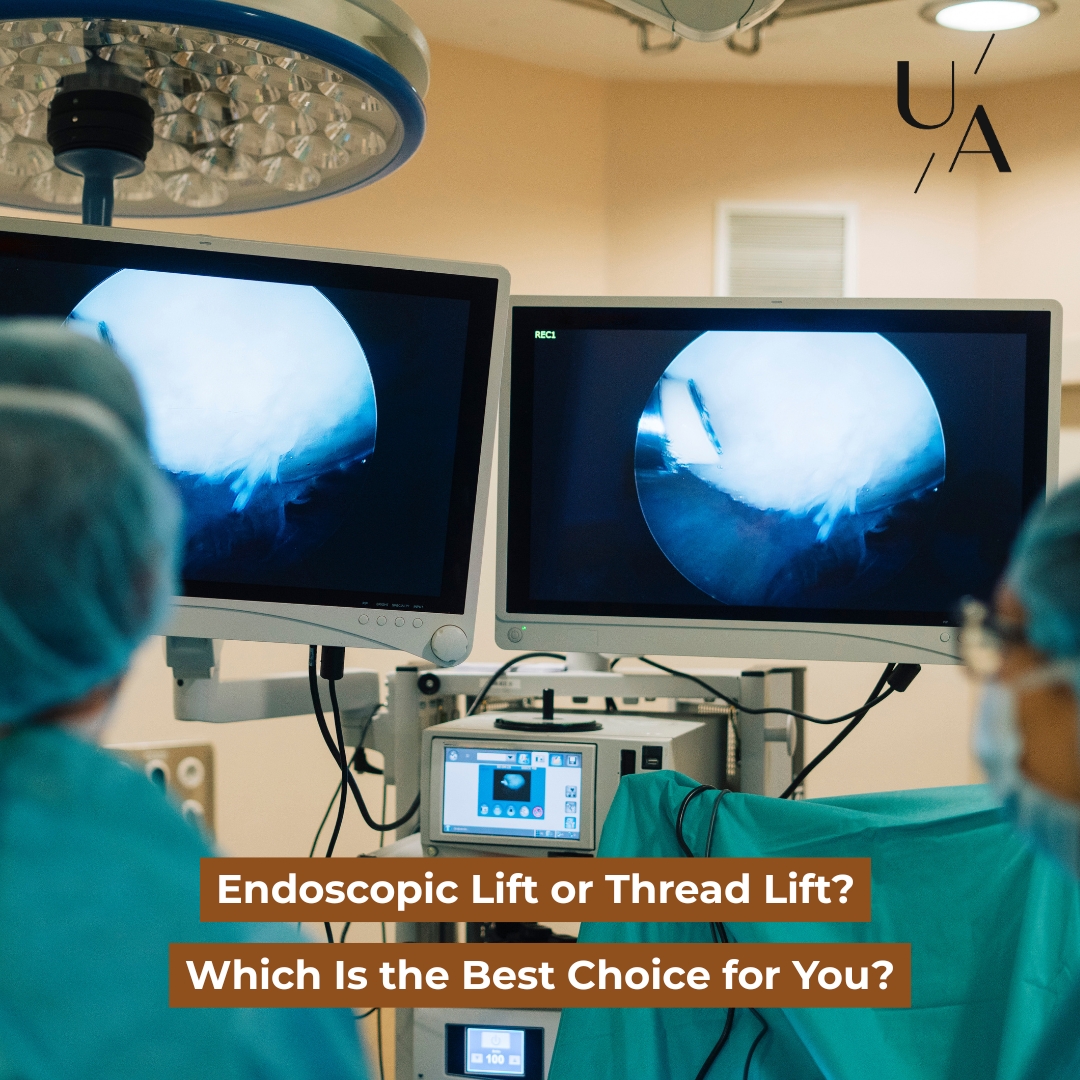 Endoscopic Lift or Thread Lift