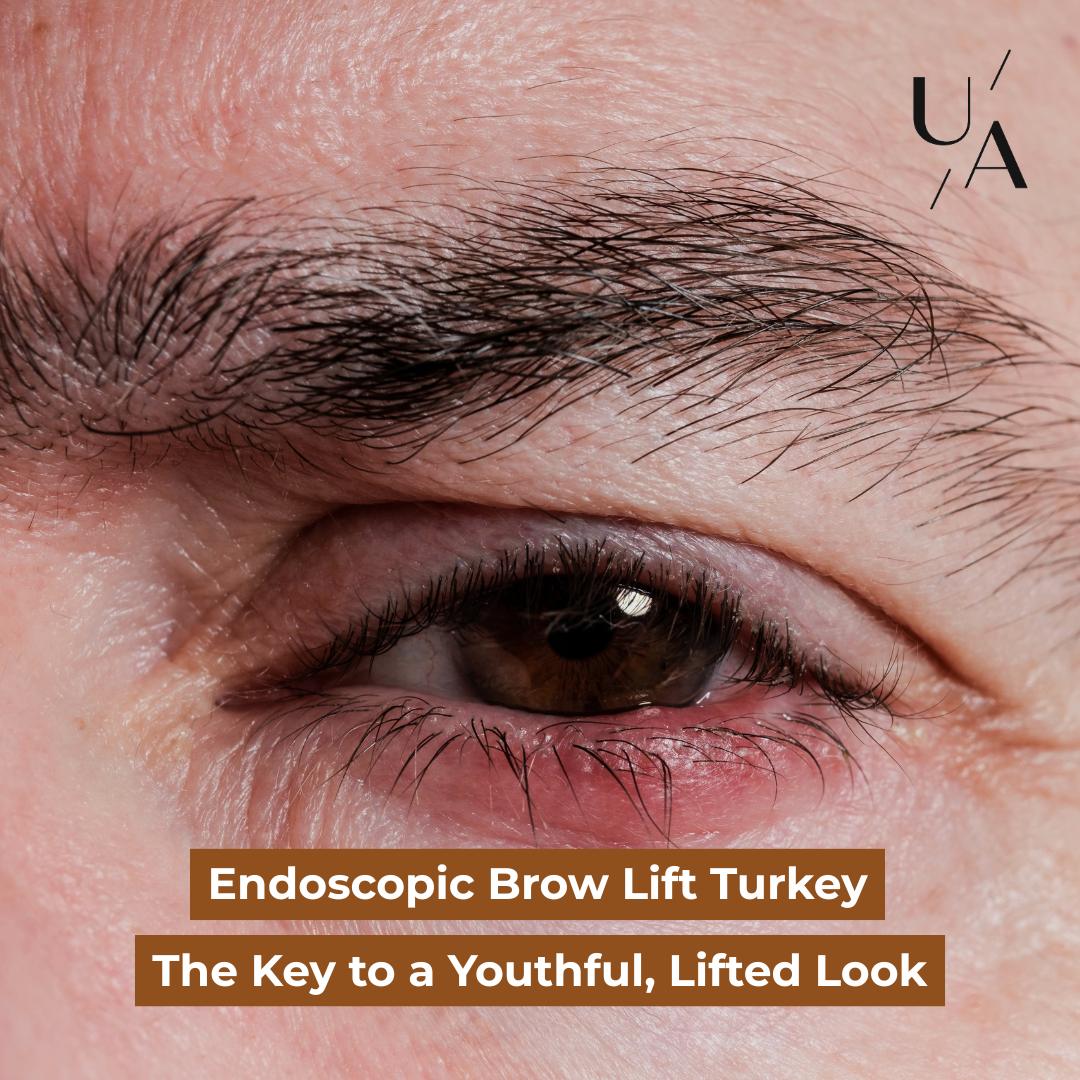 Endoscopic Brow Lift Turkey