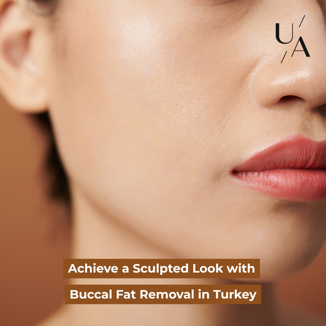 Buccal Fat Removal Turkey