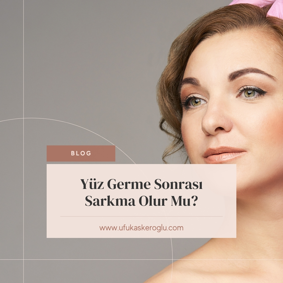 Yüz Germe Sonrası Sarkma Olur Mu
