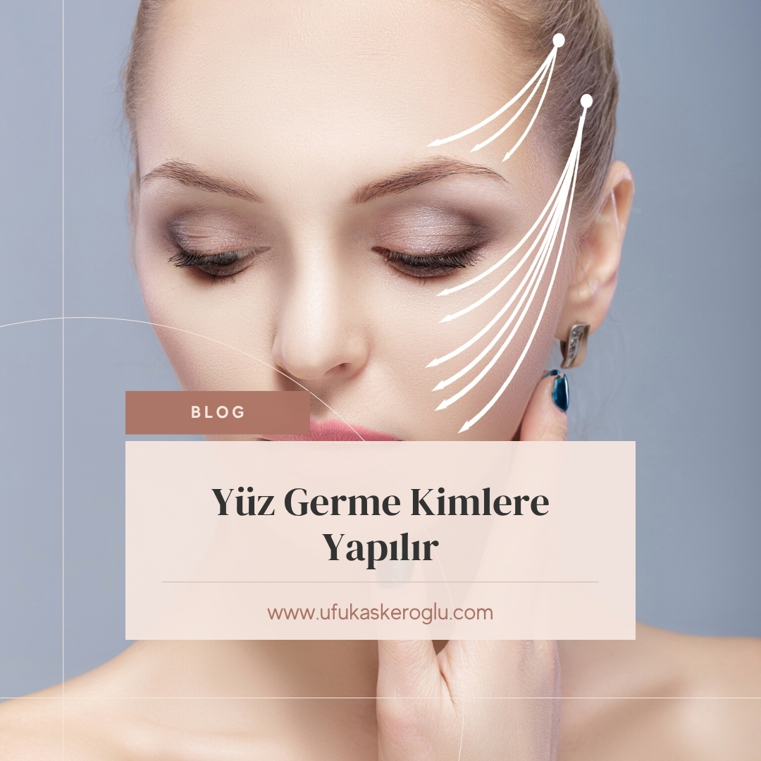 Yüz Germe Kimlere Yapılır