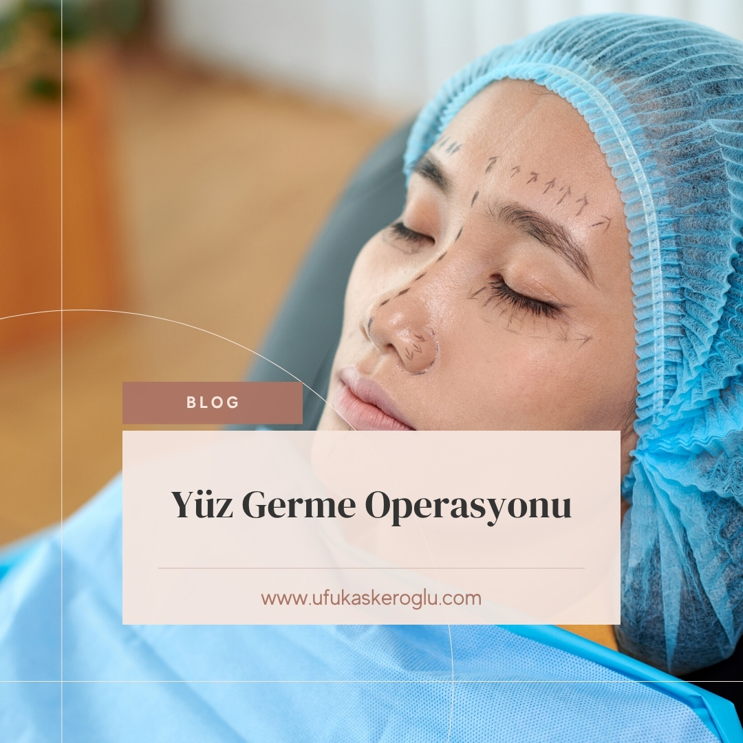 Yüz Germe Operasyonu