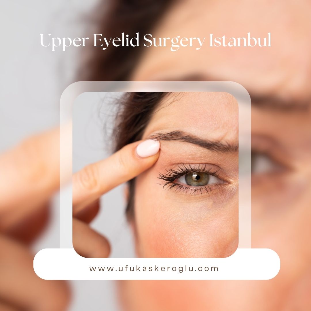 Upper Eyelid Surgery Istanbul