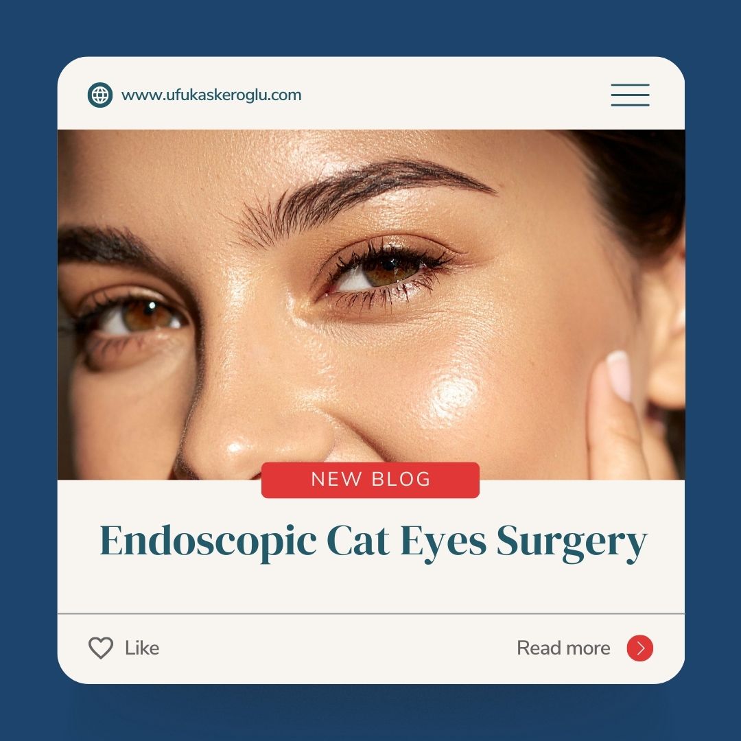 Endoscopic Cat Eye Surgery Turkey