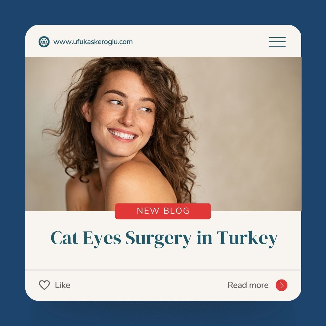 Cat Eyes Surgery in Turkey