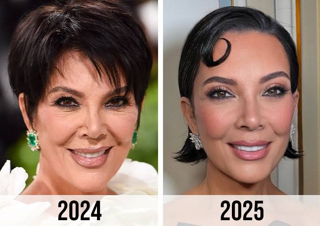 Kris Jenner Plastic Surgeon