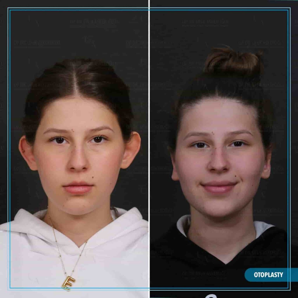 2-3-1536x1536