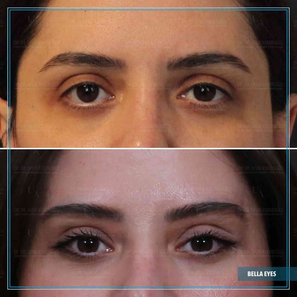 25-1536x1536